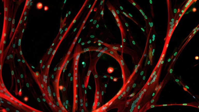 Cientistas portugueses criam campanha de informação no YouTube para clarificar dúvidas sobre as vacinas para a COVID-19