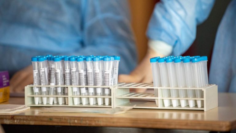 Testes rápidos de antigénio passam a ser comparticipados a 100%